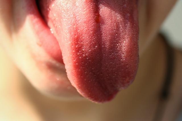 Μια υγιής γλώσσα έχει κόκκινο ή ροζ χρώμα. 