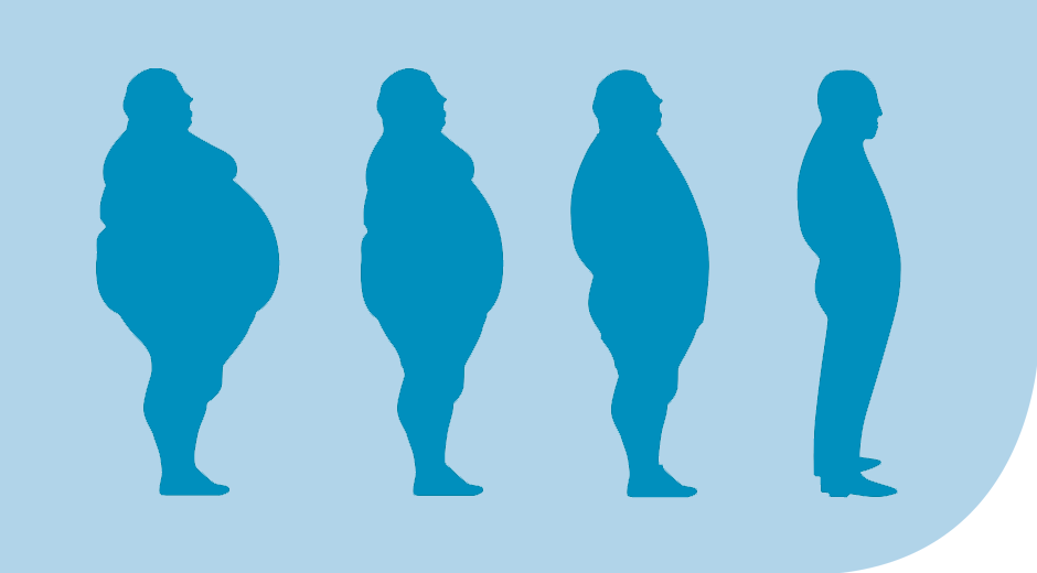 Η παχυσαρκία αποτελεί πρόβλημα στην Ελλάδα