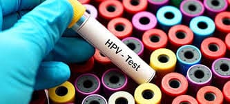 Ας μην ξεχνάμε ότι η έγκαιρη διάγνωση με εξετάσεις, όπως το τεστ Παπανικολάου, ειδικά HPV-DNA τεστ, η κολποσκόπηση και η βιοψία, μπορεί να οδηγήσουν στην έγκαιρη και αποτελεσματική θεραπεία
