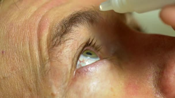 Ένα μικρό ποσοστό των οφθαλμικών σταγόνων περνάει στον οργανισμό, γι’ αυτό και οι περισσότερες παρενέργειες είναι τοπικού χαρακτήρα, δηλαδή επηρεάζουν κατά κύριο λόγο τα μάτια.