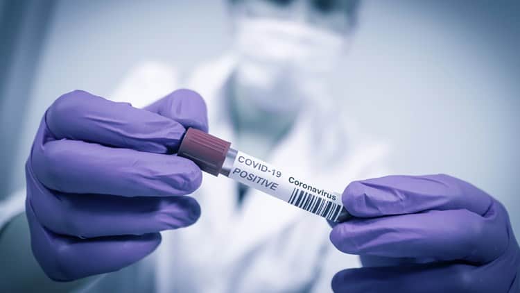 Οι επιδημιολόγοι των ΗΠΑ τονίζουν ότι, απουσία εμβολίου, τα περισσότερα άτομα εξακολουθούν να είναι ευάλωτα στη μόλυνση από τον ιό και η νέα μόδα των «COVID πάρτυ» που αρχίζει να διαδίδεται στις ΗΠΑ είναι μια ιδιαίτερα επικίνδυνη πρακτική.