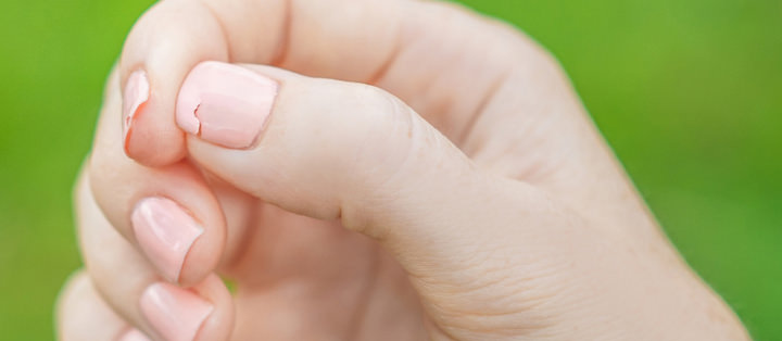 Νύχια που Σπάνε Εύκολα – Πώς Μπορείτε να Αντιμετωπίσετε το Πρόβλημα.