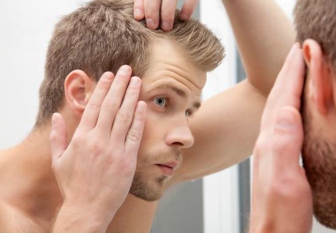 Η αλωπεκία στους άνδρες ξεκινάει με την πτώση των μαλλιών από το μέτωπο προς τα πίσω.